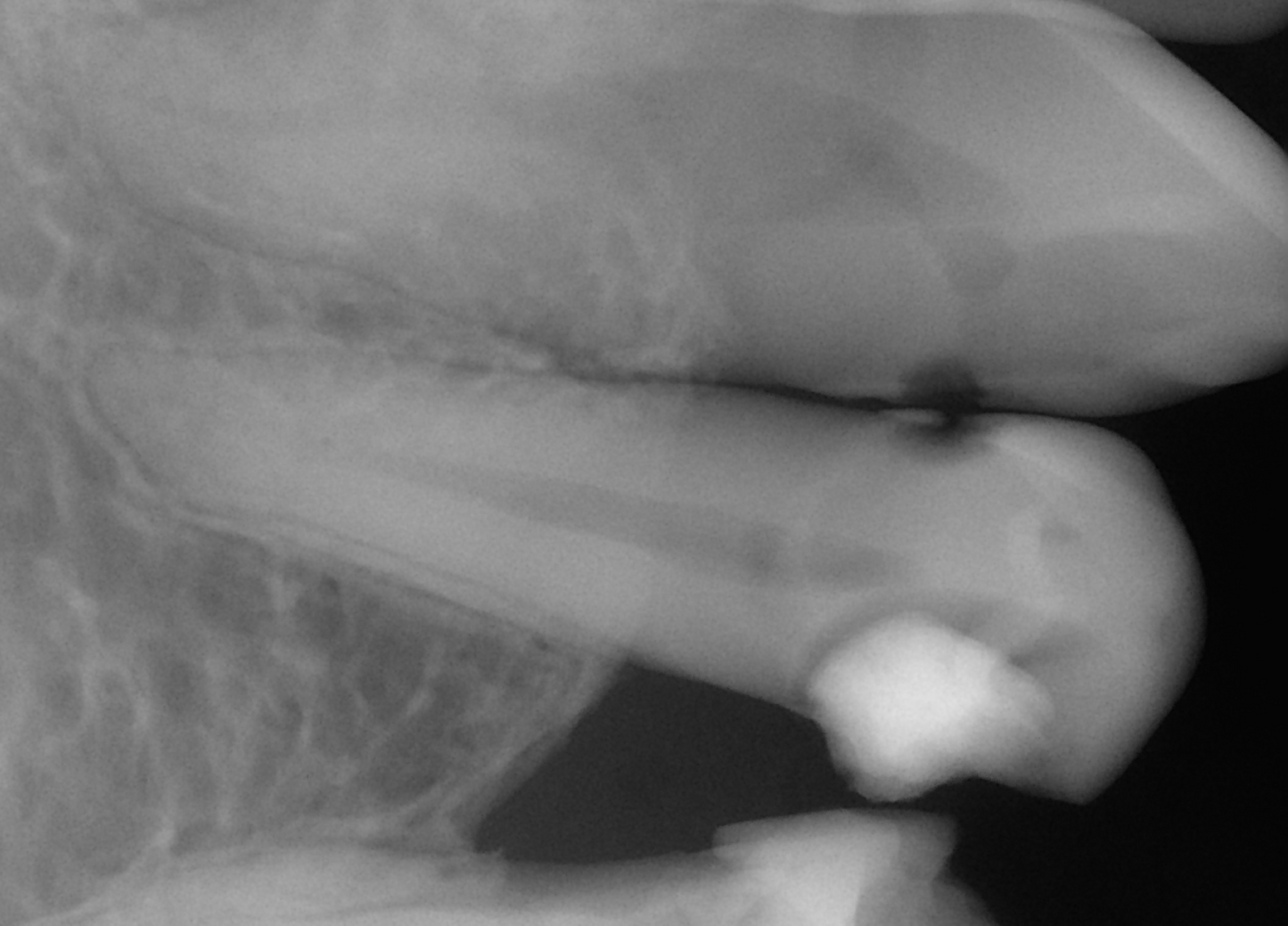 Dental Care