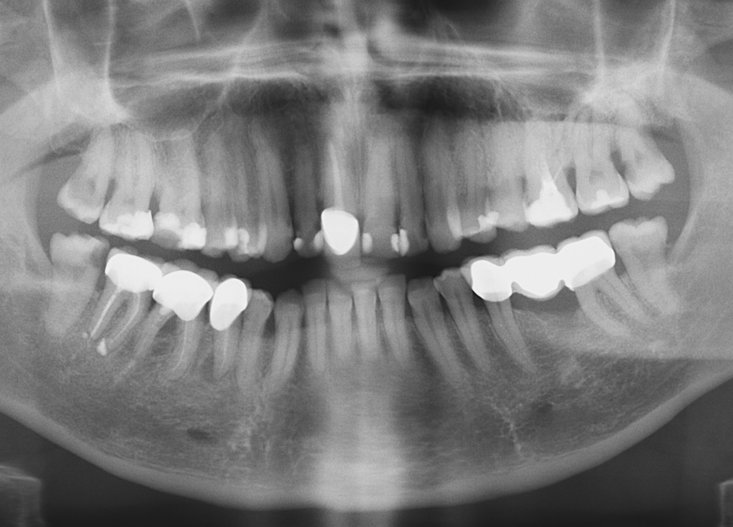 Dental Care